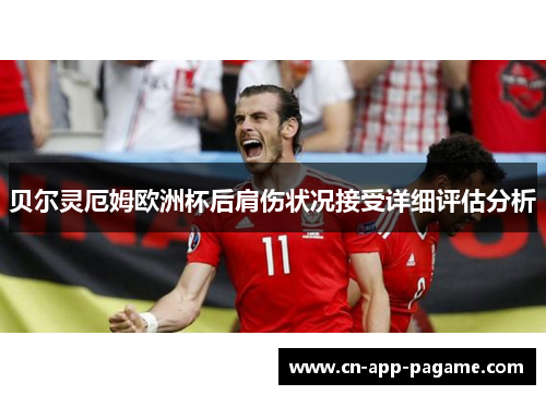 贝尔灵厄姆欧洲杯后肩伤状况接受详细评估分析 贝尔灵厄姆欧洲杯后肩伤状况接受详细评估分析